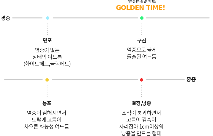 여드름 흉터를 남기지 않는 GOLDEN TIME!